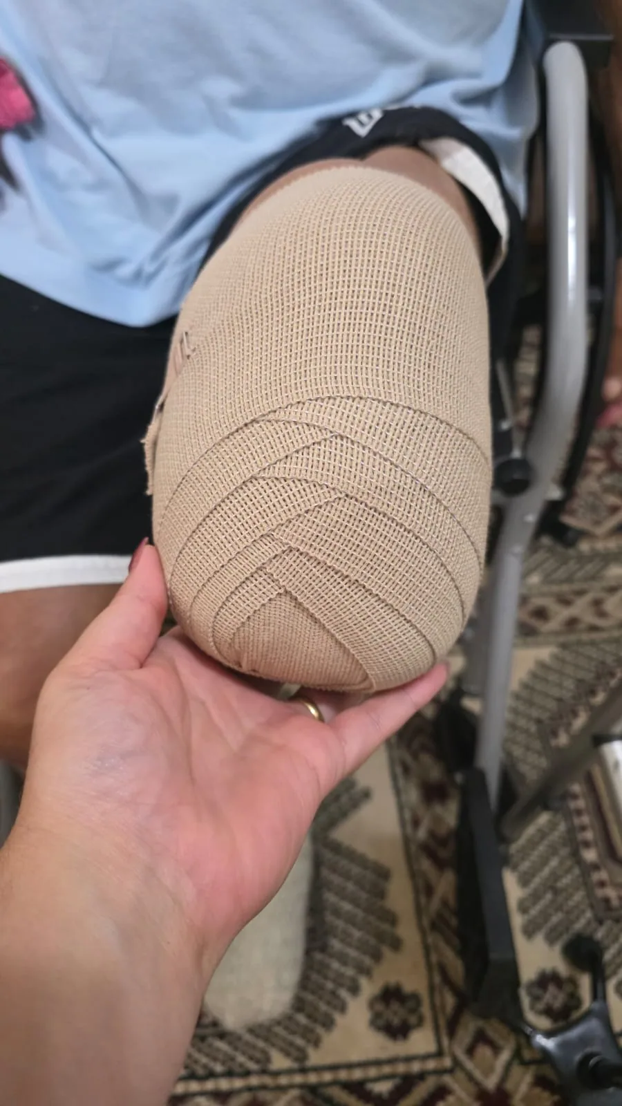 Mão da fisioterapeuta sustenta o coto de uma perna com bandagem cirúrgica em cadeira de rodas.